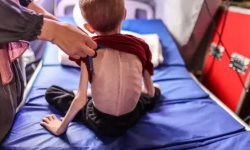 "أونروا":‏واحد من كل خمسة أطفال في غزة يعاني الآن من سوء التغذية